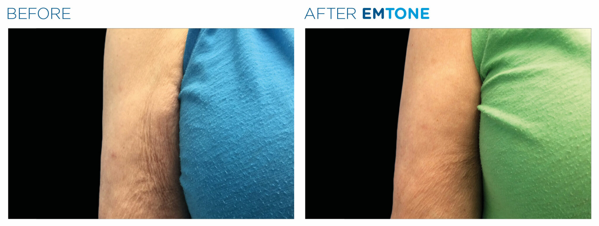 Body Contouring Marcos Medical Care