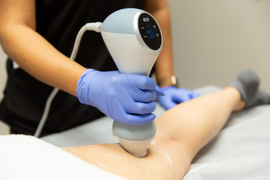 A Marcos Medical provider uses the handheld Emtone machine on a patient's upper thigh for body sculpting in San Antonio. Only the right arm and hand of the provider is in focus, and only the patient's right leg is in the image.