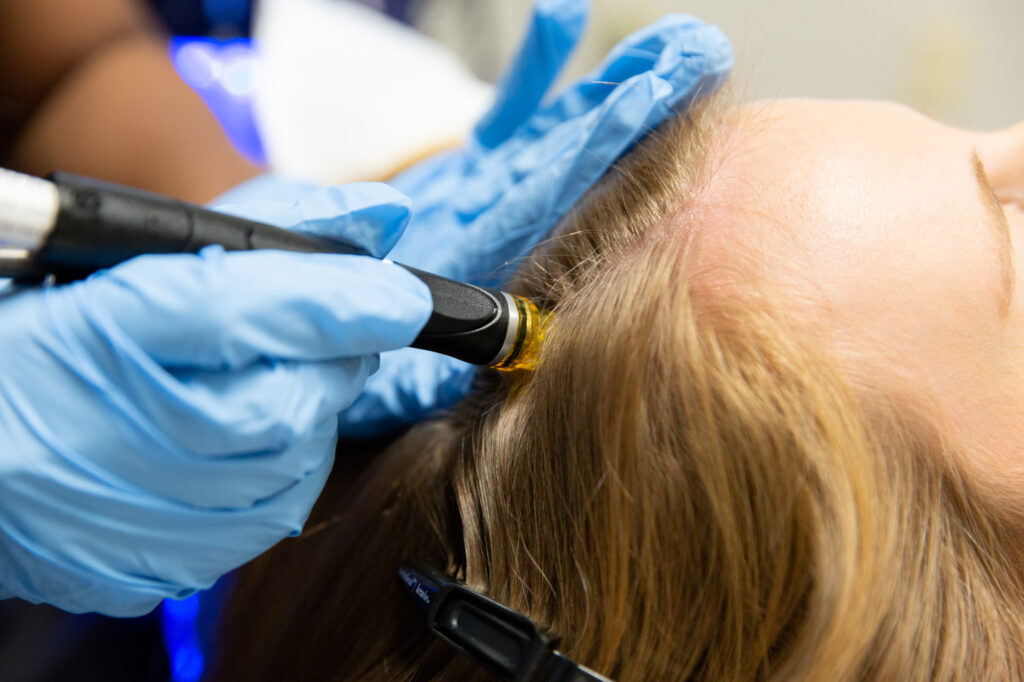 Marcos Medical Provider administering Keravive treatment to a female patient