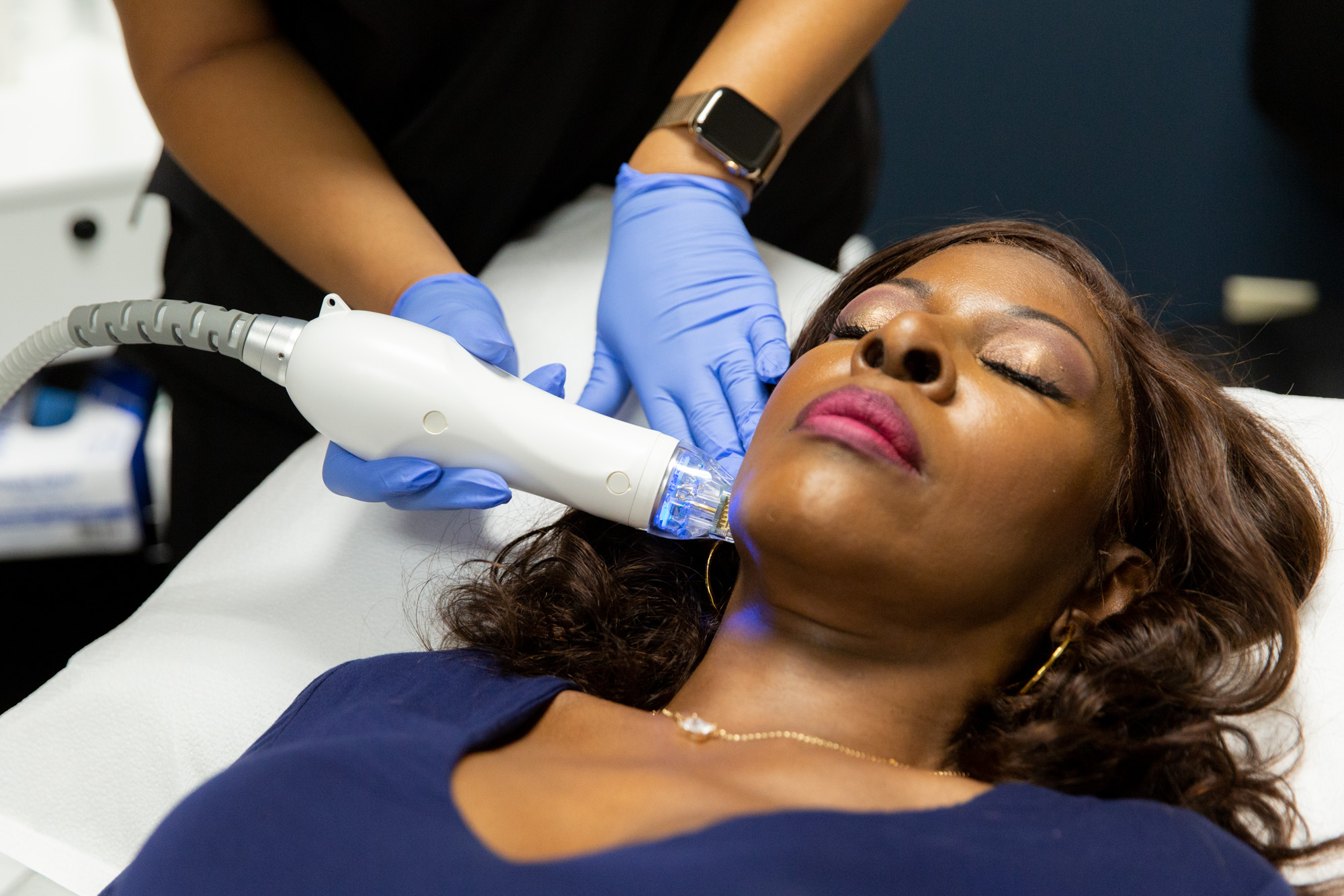 Marcos Medical provider uses handheld microneedling tool on female patient's jawline. Patient is laying down on her back.