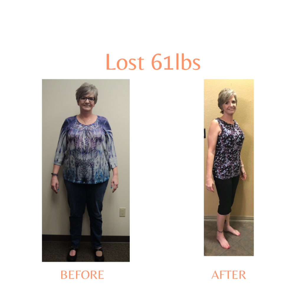 A Side By Side Image of Woman Before and After Experiencing Weight Loss with Marcos Medical. Lost 61 Pounds. Left Side is Before, Right Side is After