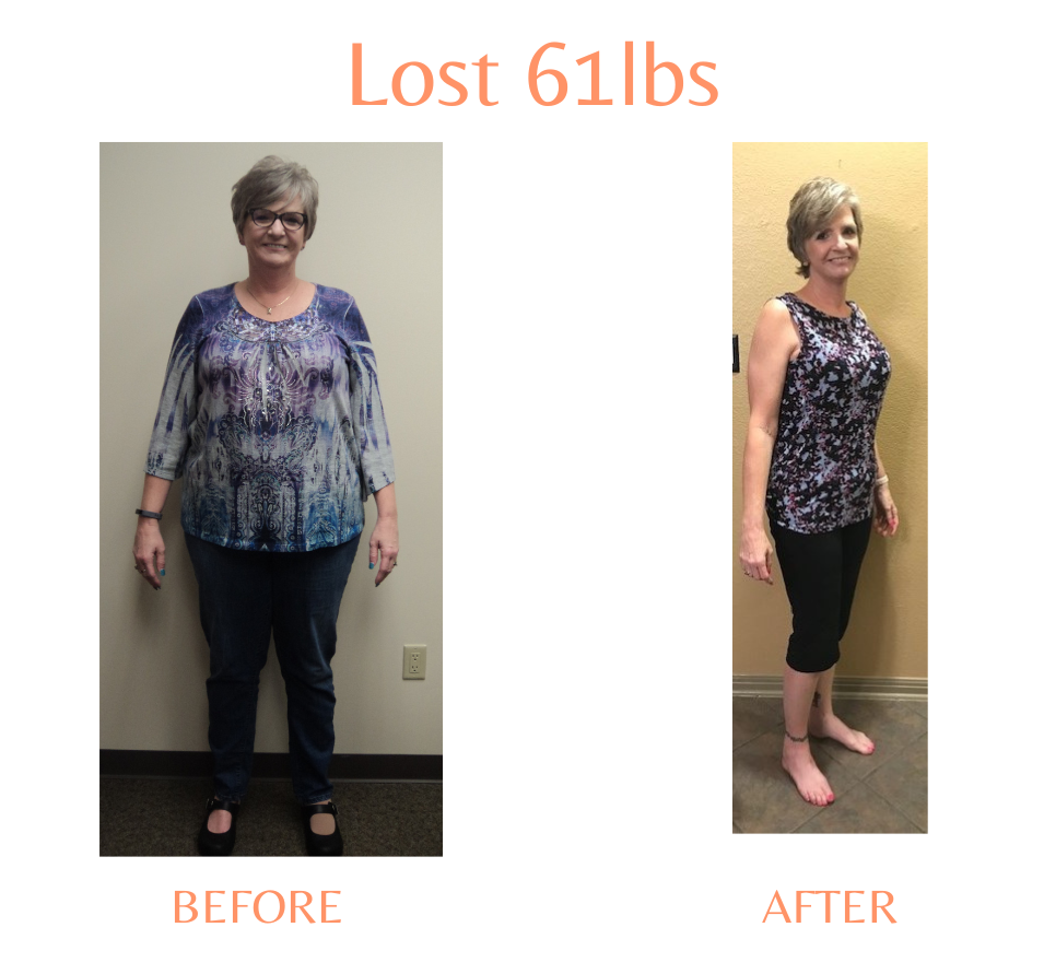 A Side By Side Image of Woman Before and After Experiencing Weight Loss with Marcos Medical. Lost 61 Pounds. Left Side is Before, Right Side is After