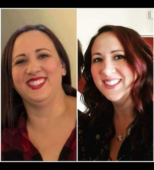 Side by Side Image of Woman Before and After Experiencing Weight Loss with Marcos Medical. Left Picture is Before, Right Picture is After