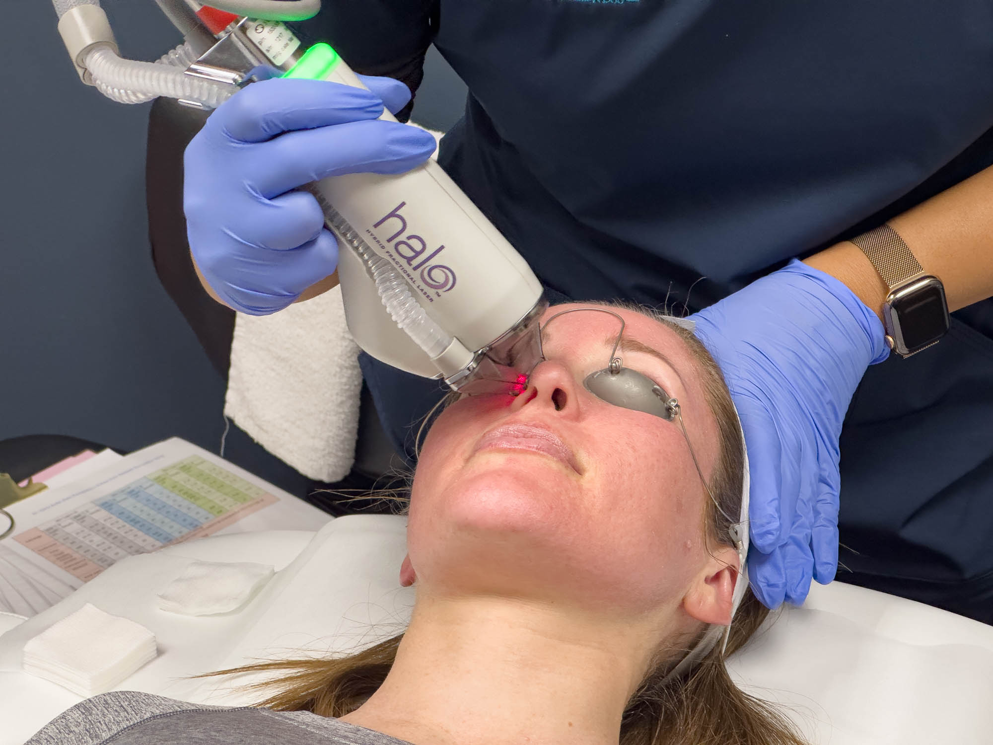Marcos Medical provider uses the Halo laser treatment on the outside of patient's right nostril. Provider's face is not visible. Patient wears protective eye covering.
